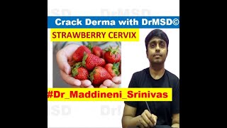 TRICHOMONIASIS | Strawberry Cervix | COLPITIS Macularis | LGV | Chancroid | Syphilis | Candida |