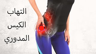 التهاب الكيس (الجراب) المدوري  Trochanteric Bursitis