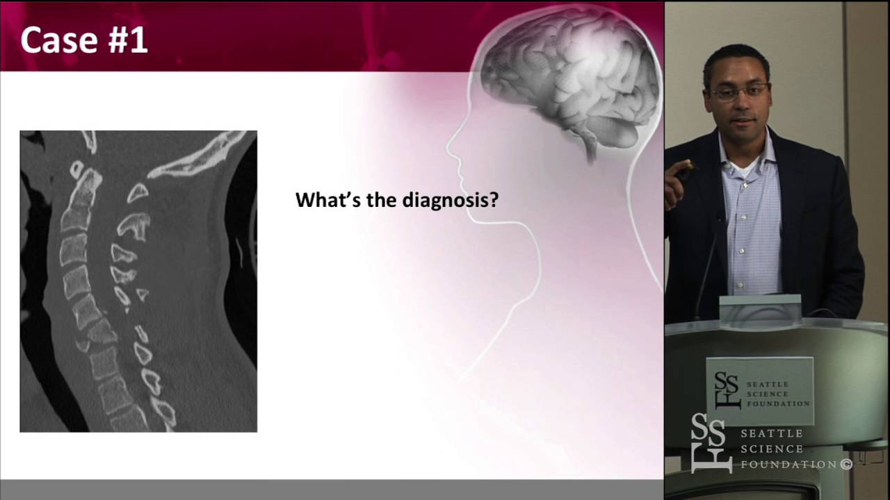 Cervical Spine Trauma- Operative and Non-Operative Management - David O. Okonkwo, MD, PhD