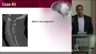 Cervical Spine Trauma- Operative and Non-Operative Management - David O. Okonkwo, MD, PhD