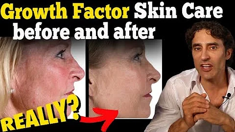 IS GROWTH FACTOR SKIN CARE WORTH IT?? || Dr Rajani