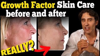 What are growth factors in skin care? - TODAY