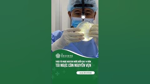 Tháo túi ngực nước biển Mentor sau 14 năm, túi ngực còn nguyên vẹn #nângngực