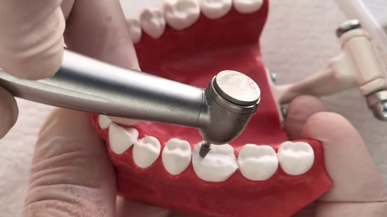 DERS-2 İNLEY-ONLEY PREPARASYON ÖRNEKLERİ