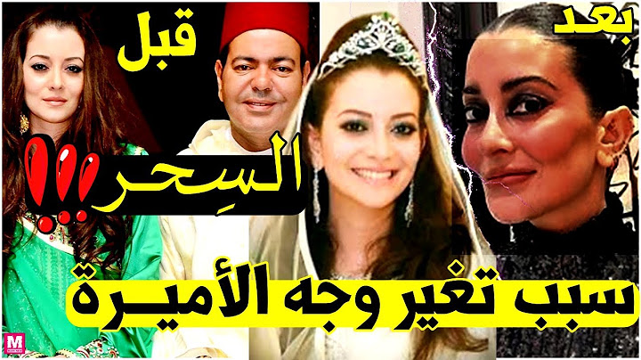 سِــر تغير وجه الأميرة أم كلثوم زوجة الأمير مولاي رشيد \ أسرار صادمة \ حياتها الشخصية \ Molay Rachid