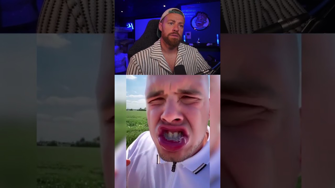 How Is He Alive?! 😱💀