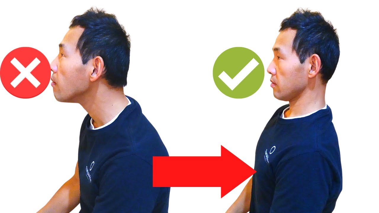 FIX FORWARD HEAD AND NECK PAIN Unclock Thoracic Spine YouTube FIX FORWARD HEAD AND NECK PAIN Unclock Thoracic Spine YouTube