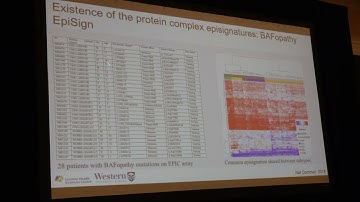 Bekim Sadikovic, PhD -  DNA Methylation Episignatures (2023 SERN/SERGG Annual Meeting)