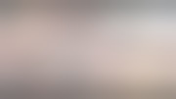 Robotic right hemicolectomy complete mesocolic excision  Supraileal approach