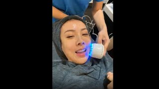 My Face Treatment Vlog Soraya Upaiprom Elite Clinic Udonthani