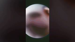 XD