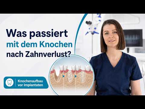 Video: Was ist ein Knochenaufbau und warum ist er nötig? – PureDental Budapest