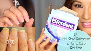 How to Get Rid of Yellow Nails & Dry Hands ( CLOSED Giveaway L'Occitane & London Butter)