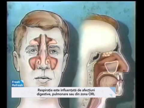 Video: Femeia Scotiană Are Un Cadou Incredibil Pentru Mirosirea Bolii Parkinson - Vedere Alternativă