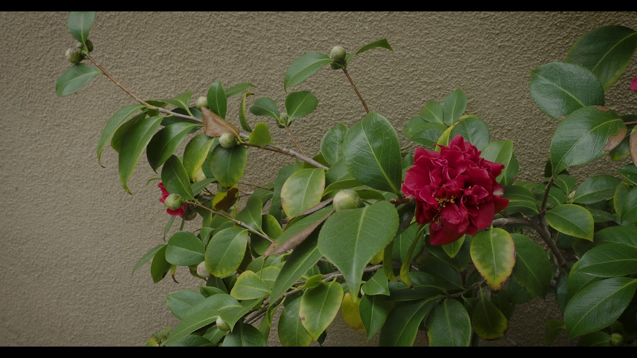 Mitral Valve Prolapse heath update