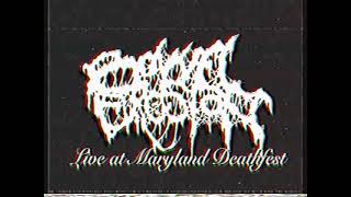 Download Lagu Hood5six x Shitgazer Presents: Bowel Erosion Live at MDF 5/26/2022 Soundstage Baltimore, MD MP3
