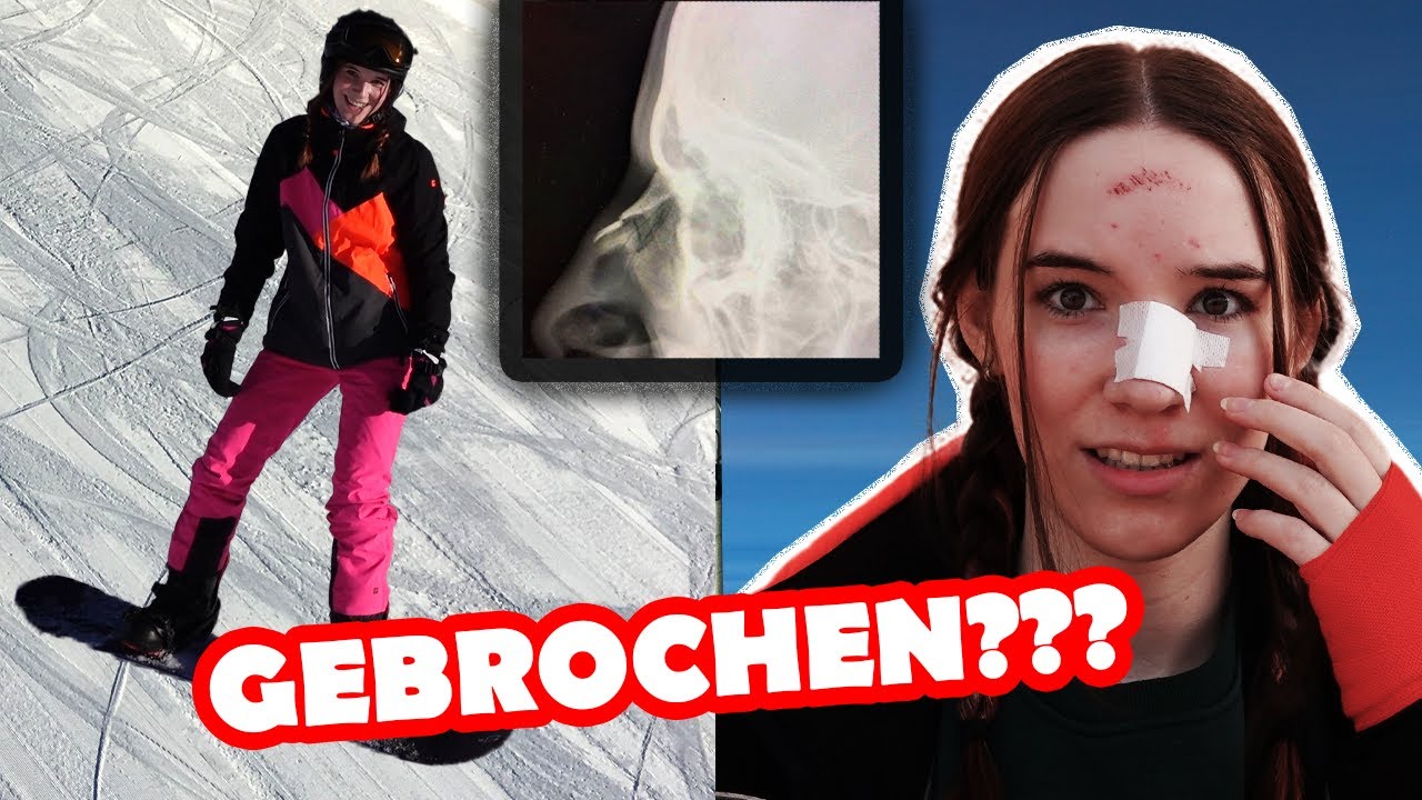 SKIURLAUB endet im KRANKENHAUS😳😨 @itsmanjuu