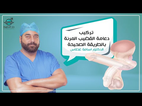 تركيب دعامة القضيب المرنة بالطريقة الصحيحة |الدكتور اسامة غطاس | 4958