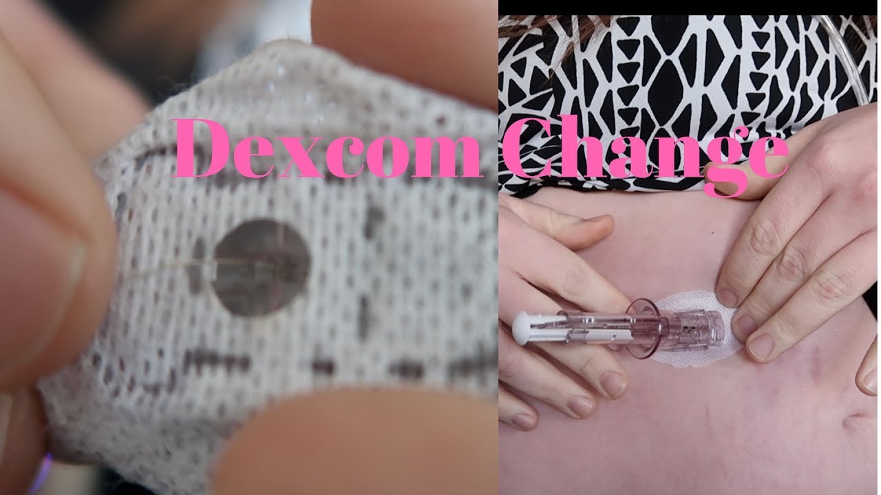 Dexcom Reader Sensor. Change Dexcom Sensor Change π(1.25.18) - YouTube