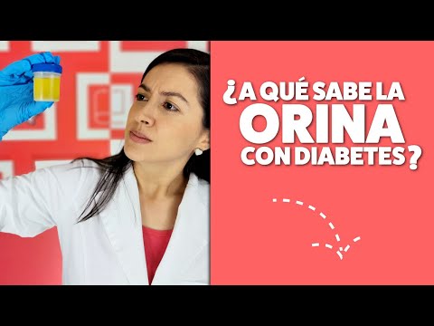 ¿Qué es la