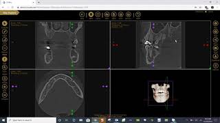 Training: Apteryx XVWeb 3D: Slide and Zoom Tools