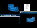 Handheld scan tooth VS Desktop scan tooth