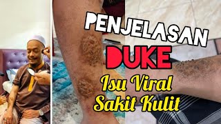 Ustaz Kazim Elias Beri Penjelasan Isu Viral Lakonan Sakit Kulit atau Sihir