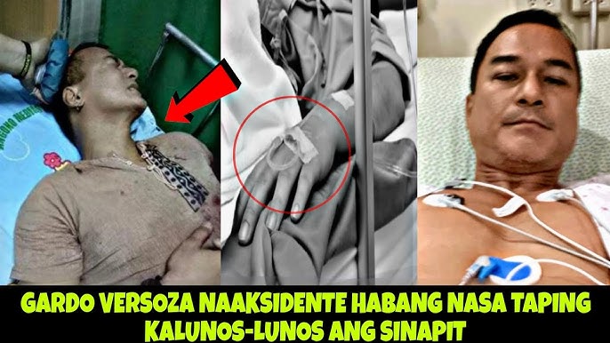 GARDO VERSOZA NAAKSIDENTE HABANG NASA TAPING,AGAW BUH4Y!KALUNOS-LUNOS ANG  SINAPIT
