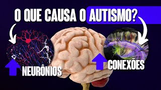 COMO É O CÉREBRO AUTISTA?