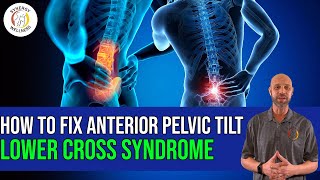 How To Fix Anterior Pelvic Tilt (Lower Cross Syndrome)