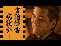 加山雄三の言語障害や麻痺の病状...松本めぐみと『卒婚』後の極貧介護生活に涙が零れ落ちた...「サライ」で有名な紅白歌手の火災事件や事業失敗で抱えた借金との戦いに驚きを隠せない...