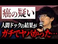 【ガンの疑い】人間ドックの結果がマジでヤバかった…