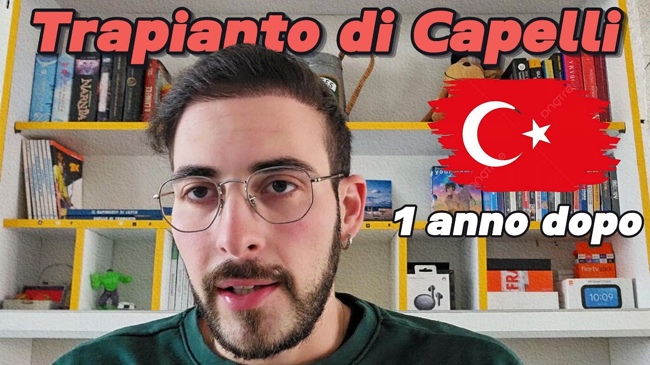 Il mio TRAPIANTO DI CAPELLI 1 anno dopo e la mia Terapia farmacologica 👨🏻‍🦱🇨🇳