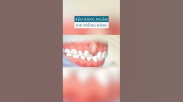 Cách kéo răng mọc ngầm khi niềng răng #shorts #braces