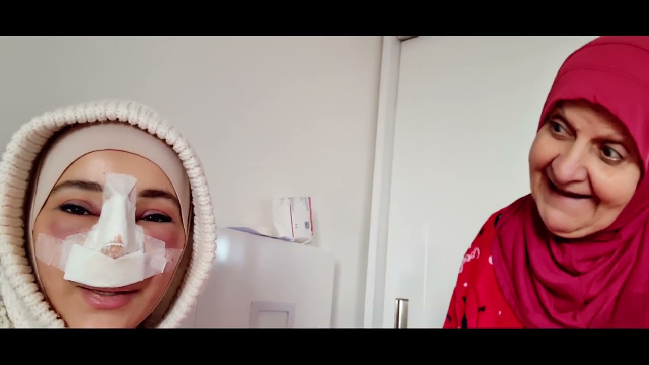 شوفو شو صار فيني بعد العملية !! - تابع (2)