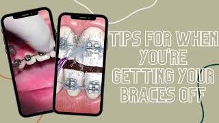 Tips For When You're Getting Your Braces Off #shorts