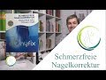 Onyfix - Schmerzfreie Nagelkorrektur