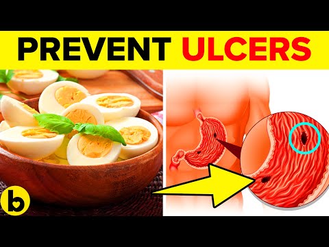 Video: 7 Popular Recipes To Help Heal Trophic Ulcers