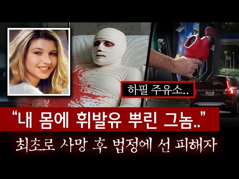 전신 90% 화상을 입은 그날, 탄산음료 한컵에서 시작된 지옥같은 악몽