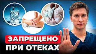 Что НЕЛЬЗЯ и что НУЖНО при отеках! Советы флеболога