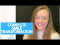 Complete Smile Transformation Before and After