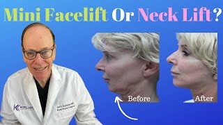 Celebrity Reasons for a Mini Facelift or Neck Lift Surgery | Plastic Surgeon's Opinion Wealth