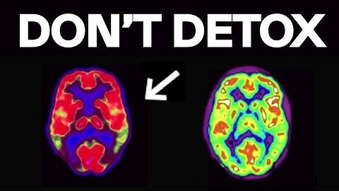 How To Reprogram Your Dopamine To Crave Hard Work