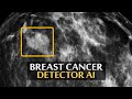 DeepMind’s New AI Helps Detecting Breast Cancer