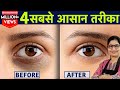 1 ही रात मे आंखों के काले घेरे हटाने के घरेलू नुस्खे | Dark Circles Kaise Hataye, Remove Dark Circle