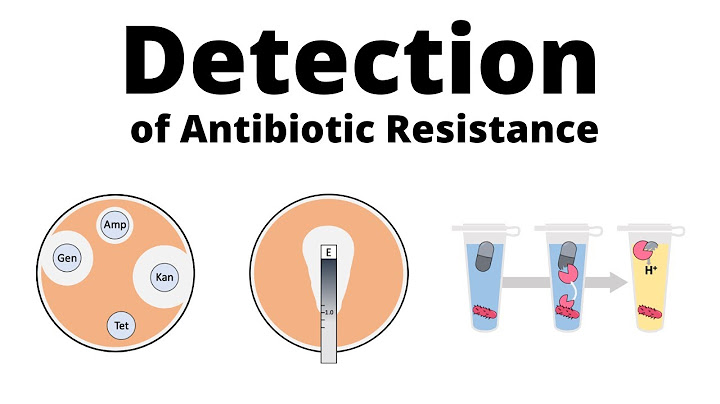 Antibiotic resistance can we ever win worksheet answers