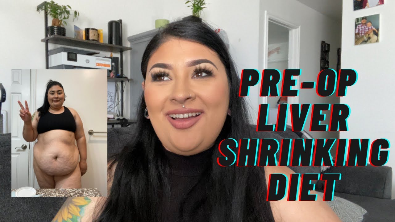 PreOp Liver Shrinking Diet for Bariatric Surgery YouTube