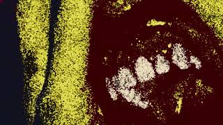 Entropic Degrade Behind Phylogeny - Stench Of Carnage Gore Beyond Necropsy