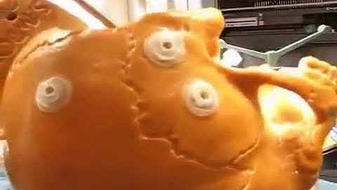 Image guided robot for skull base surgery