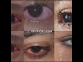 ... #shorts #eyes #alcohol #drug #sad #crying #tears #girlshorts #verysad #verysadstatus